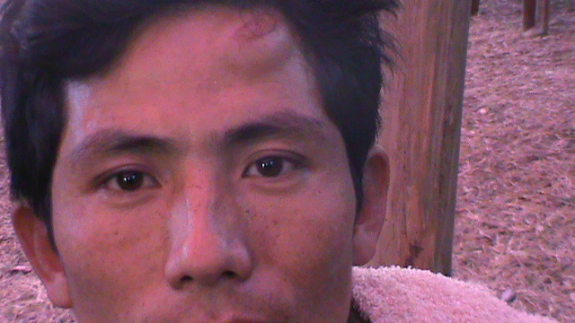 A Public hearing held by Suppressing the Public: The Injury Mark from the Lathi charge is Clear on his Forehead